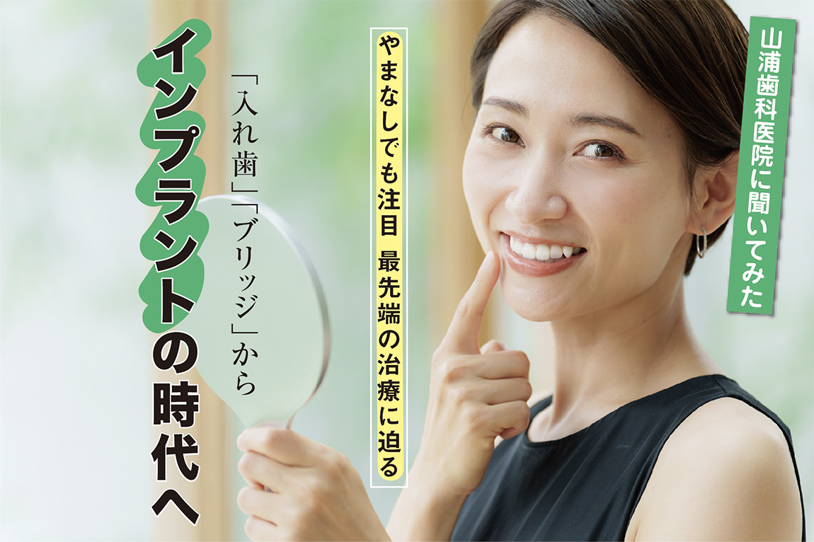 インプラント治療とは？〜その仕組みとメリット〜｜やまなしでも注目！最先端の治療をインプラントのスペシャリストに聞いてみた！「入れ歯」「ブリッジ」からインプラントの時代へ - ナシロー｜やまなしローカルつーしん｜山梨県の情報サイト